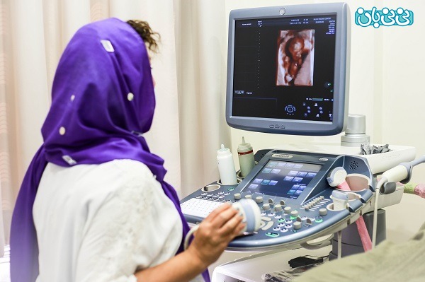 احتمال اشتباه در سونوگرافی تعیین جنسیت احتمال اشتباه در سونوگرافی تعیین جنسیت